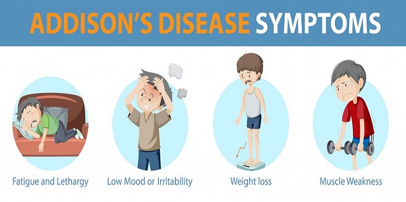 What Is Addison S Disease Symptoms Causes Diagnosis Treatment And